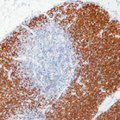 DNTT / TdT Antibody - Formalin-fixed, paraffin-embedded human thymus stained with peroxidase-conjugate and DAB chromogen. Note nuclear staining of thymocytes.
