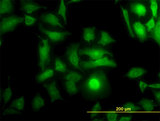 DOCK4 Antibody - Immunofluorescence of monoclonal antibody to DOCK4 on HeLa cell (antibody concentration 10 ug/ml).