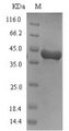 Arginine esterase Protein - (Tris-Glycine gel) Discontinuous SDS-PAGE (reduced) with 5% enrichment gel and 15% separation gel.