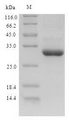 CSF3 / G-CSF Protein - (Tris-Glycine gel) Discontinuous SDS-PAGE (reduced) with 5% enrichment gel and 15% separation gel.