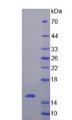 Procalcitonin Protein - Recombinant Procalcitonin (PCT) by SDS-PAGE