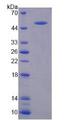 VWF / Von Willebrand Factor Protein - Recombinant Von Willebrand Factor By SDS-PAGE