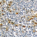 DOK6 Antibody - Immunohistochemical analysis of DOK6 staining in human lymph node formalin fixed paraffin embedded tissue section. The section was pre-treated using heat mediated antigen retrieval with sodium citrate buffer (pH 6.0). The section was then incubated with the antibody at room temperature and detected with HRP and DAB as chromogen. The section was then counterstained with hematoxylin and mounted with DPX.