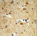 DOLK Antibody - Formalin-fixed and paraffin-embedded human brain tissue reacted with DOLK Antibody , which was peroxidase-conjugated to the secondary antibody, followed by DAB staining. This data demonstrates the use of this antibody for immunohistochemistry; clinical relevance has not been evaluated.