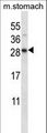 DOLPP1 Antibody - DOLPP1 Antibody western blot of mouse stomach tissue lysates (35 ug/lane). The DOLPP1 antibody detected the DOLPP1 protein (arrow).