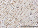 DP97 / DDX54 Antibody - Immunoperoxidase of monoclonal antibody to DDX54 on formalin-fixed paraffin-embedded human stomach. [antibody concentration 3 ug/ml]