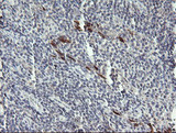 DPCD Antibody - IHC of paraffin-embedded Human lymphoma tissue using anti-DPCD mouse monoclonal antibody. (Heat-induced epitope retrieval by 10mM citric buffer, pH6.0, 120°C for 3min).