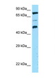 DPP4 / CD26 Antibody - DPP4 / CD26 antibody Western blot of HCT15 Cell lysate. Antibody concentration 1 ug/ml.  This image was taken for the unconjugated form of this product. Other forms have not been tested.