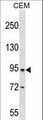 DPP4 / CD26 Antibody - DPP4 Antibody western blot of CEM cell line lysates (35 ug/lane). The DPP4 antibody detected the DPP4 protein (arrow).