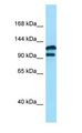DPP9 Antibody - DPP9 antibody Western Blot of MCF7.  This image was taken for the unconjugated form of this product. Other forms have not been tested.