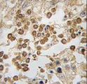 DPPA4 Antibody - Formalin-fixed and paraffin-embedded human testis tissue reacted with DPPA4 antibody , which was peroxidase-conjugated to the secondary antibody, followed by DAB staining. This data demonstrates the use of this antibody for immunohistochemistry; clinical relevance has not been evaluated.