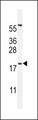 DPPA5 Antibody - DPPA5 Antibody western blot of HL-60 cell line lysates (35 ug/lane). The DPPA5 antibody detected the DPPA5 protein (arrow).