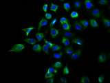 DPY19L2 Antibody - Immunofluorescence staining of A549 cells diluted at 1:133, counter-stained with DAPI. The cells were fixed in 4% formaldehyde, permeabilized using 0.2% Triton X-100 and blocked in 10% normal Goat Serum. The cells were then incubated with the antibody overnight at 4°C.The Secondary antibody was Alexa Fluor 488-congugated AffiniPure Goat Anti-Rabbit IgG (H+L).