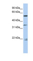 DPYSL2 / CRMP2 Antibody - DPYSL2 / CRMP2 antibody Western blot of Fetal Brain lysate. This image was taken for the unconjugated form of this product. Other forms have not been tested.