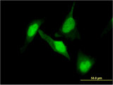 DPYSL2 / CRMP2 Antibody - Immunofluorescence of monoclonal antibody to DPYSL2 on HeLa cell . [antibody concentration 10 ug/ml]