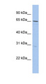 DQX1 Antibody - DQX1 antibody Western blot of OVCAR-3 cell lysate. This image was taken for the unconjugated form of this product. Other forms have not been tested.