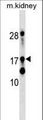 DR1 / NC2 Antibody - DR1 Antibody western blot of mouse kidney tissue lysates (35 ug/lane). The DR1 antibody detected the DR1 protein (arrow).