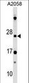DRAP1 Antibody - DRAP1 Antibody western blot of A2058 cell line lysates (35 ug/lane). The DRAP1 antibody detected the DRAP1 protein (arrow).