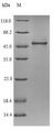 ND-75 Protein - (Tris-Glycine gel) Discontinuous SDS-PAGE (reduced) with 5% enrichment gel and 15% separation gel.