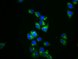 DRP2 Antibody - Immunofluorescence staining of Hela cells diluted at 1:133, counter-stained with DAPI. The cells were fixed in 4% formaldehyde, permeabilized using 0.2% Triton X-100 and blocked in 10% normal Goat Serum. The cells were then incubated with the antibody overnight at 4°C.The Secondary antibody was Alexa Fluor 488-congugated AffiniPure Goat Anti-Rabbit IgG (H+L).