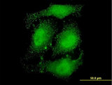 DRPLA / Atrophin-1 Antibody - Immunofluorescence of monoclonal antibody to ATN1 on HeLa cell . [antibody concentration 10 ug/ml]
