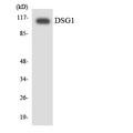 DSG1 / Desmoglein 1 Antibody - Western blot analysis of the lysates from 293 cells using DSG1 antibody.