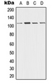 DSG3 / Desmoglein 3 Antibody - Western blot analysis of Desmoglein 3 expression in A431 (A); HeLa (B); Raw264.7 (C); PC12 (D) whole cell lysates.