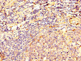 DSG3 / Desmoglein 3 Antibody - Immunohistochemistry of paraffin-embedded human tonsil tissue using DSG3 Antibody at dilution of 1:100