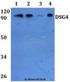 DSG4 / Desmoglein 4 Antibody - Western blot of DSG4 antibody at 1:500 dilution. Lane 1: HEK293T whole cell lysate. Lane 2: RAW264.7 whole cell lysate.