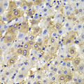 DSP / Desmoplakin Antibody - Immunohistochemistry of paraffin-embedded human liver injury tissue.