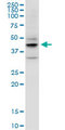 DSPG3 / Epiphycan Antibody - EPYC monoclonal antibody (M06), clone 2G6. Western Blot analysis of EPYC expression in MCF-7.