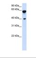 DTNB / Dystrobrevin Beta Antibody - Transfected 293T cell lysate. Antibody concentration: 1.0 ug/ml. Gel concentration: 12%.  This image was taken for the unconjugated form of this product. Other forms have not been tested.