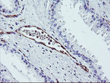 DTNB / Dystrobrevin Beta Antibody - IHC of paraffin-embedded Human prostate tissue using anti-DTNB mouse monoclonal antibody.