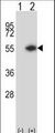 DTNBP1 / Dysbindin Antibody - Western blot of DTNBP1 (arrow) using rabbit polyclonal DTNBP1 Antibody. 293 cell lysates (2 ug/lane) either nontransfected (Lane 1) or transiently transfected (Lane 2) with the DTNBP1 gene.