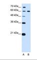 DTX2 Antibody - Lane A: Marker. Lane B: HepG2 cell lysate. Antibody concentration: 0.25 ug/ml. Gel concentration: 12%.  This image was taken for the unconjugated form of this product. Other forms have not been tested.