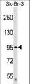 DTX3L Antibody - DTX3L Antibody western blot of SK-BR-3 cell line lysates (35 ug/lane). The DTX3L antibody detected the DTX3L protein (arrow).