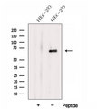 DTX4 Antibody - Western blot analysis of extracts of HEK293 cells using DTX4 antibody. The lane on the left was treated with blocking peptide.