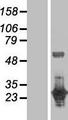 DUPD1 Protein - Western validation with an anti-DDK antibody * L: Control HEK293 lysate R: Over-expression lysate