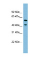 DUS1L Antibody - DUS1L antibody Western blot of HepG2 cell lysate. This image was taken for the unconjugated form of this product. Other forms have not been tested.