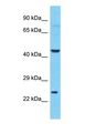 DUS3L Antibody - Western blot of DUS3L Antibody with NCI-H226 Whole Cell lysate.  This image was taken for the unconjugated form of this product. Other forms have not been tested.