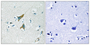 DUSP1 / MKP1 Antibody - Immunohistochemistry analysis of paraffin-embedded human brain tissue, using MKP1 Antibody. The picture on the right is blocked with the synthesized peptide.