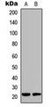 DUSP22 / JSP 1 Antibody - Western blot analysis of DUSP22 expression in HCT116 (A); Raw264.7 (B) whole cell lysates.