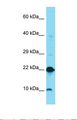 DUSP22 / JSP 1 Antibody - Western blot of Human Thyroid Tumor. DUSP22 antibody dilution 1.0 ug/ml.  This image was taken for the unconjugated form of this product. Other forms have not been tested.