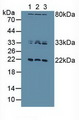 DUSP3 / VHR Antibody - Western Blot; Sample: Lane1: Human Hela Cells; Lane2: Human Jurkat Cells; Lane3: Human MCF7 Cells.