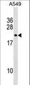 DUX3 Antibody - DUX3 Antibody western blot of A549 cell line lysates (35 ug/lane). The DUX3 antibody detected the DUX3 protein (arrow).