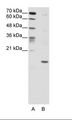 DUX5 Antibody - A: Marker, B: HepG2 Cell Lysate.  This image was taken for the unconjugated form of this product. Other forms have not been tested.