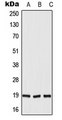 DUX5 Antibody - Western blot analysis of DUX5 expression in HepG2 (A); H9C2 (B); rat liver (C) whole cell lysates.
