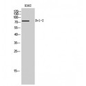 DVL2 / Dishevelled 2 Antibody - Western blot of Dvl-2 antibody