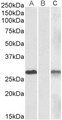 DYDC1 Antibody - Lane A - Goat Anti-DYDC1 Antibody (1µg/ml) staining of HEK293 overexpressing Human DYDC1 lysate (10µg protein in RIPA buffer) Lane B - Goat Anti-DYDC1 Antibody (1µg/ml) staining of HEK293 mock-transfected lysate (10µg protein in RIPA buffer). Lane C - anti-MYC Tag (1/1000) staining HEK293 overexpressing Human DYDC1 lysate (10µg protein in RIPA buffer). Primary incubations were for 1 hour. Detected by chemiluminescencence.