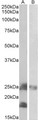 Dynactin 3 / DCTN3 Antibody - Goat Anti-DCTN3 Antibody (0.2µg/ml) staining of Mouse (A) and Rat (B) Skeletal Muscle lysates (35µg protein in RIPA buffer). Primary incubation was 1 hour. Detected by chemiluminescencence.
